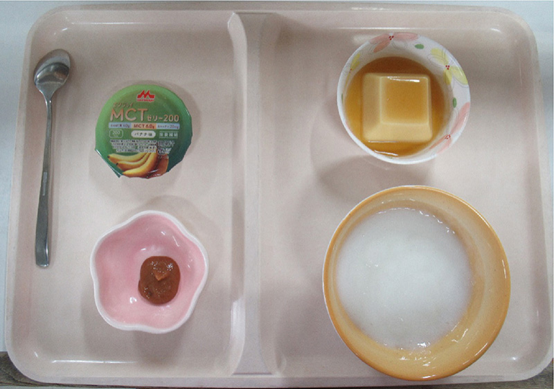 嚥下訓練食Ⅱ（コード1ｊ）